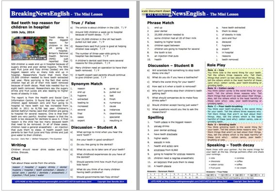 A 2-Page Mini-Lesson - Tooth Decay