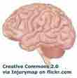 An ESL lesson on Brain Size - Criminals have smaller brain size, says study